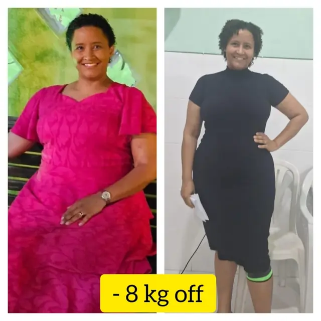 Antes e depois da Renata